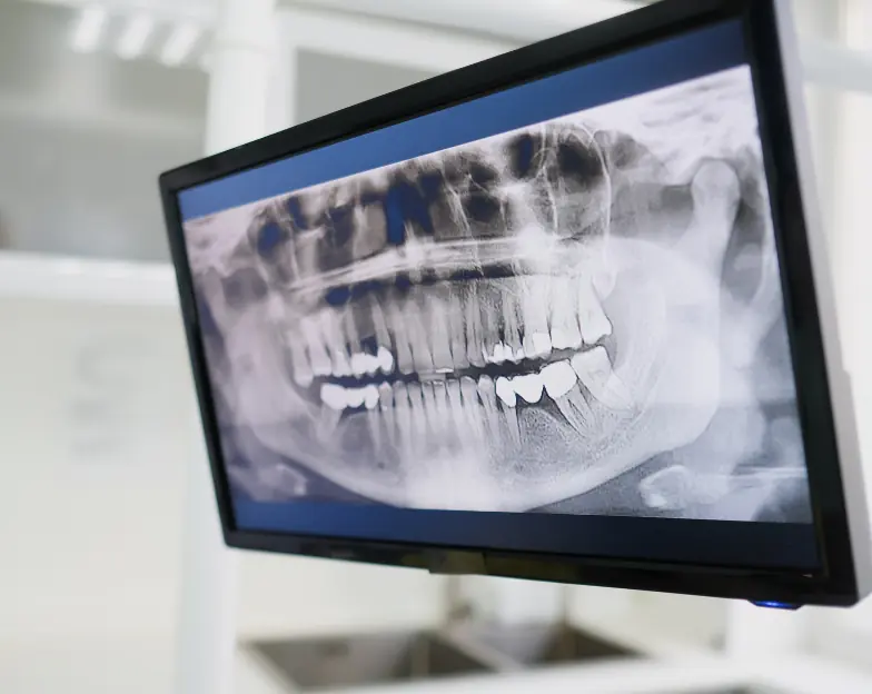 Medical and dental marketing in UAE: Panoramic dental X-ray displayed on a monitor for Specialist Dental Practices