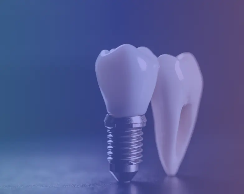 Medical and dental marketing in UAE: Dental implant model beside a tooth model for Prosthodontics and Restorative Dentistry