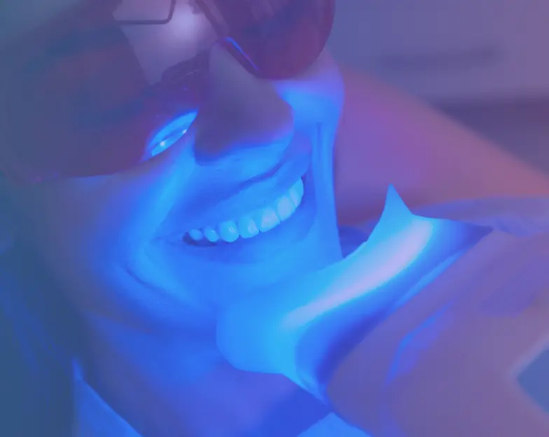 Medical and dental marketing in UAE: Blue dental light directed towards teeth in a treatment setting for Professional Teeth Whitening