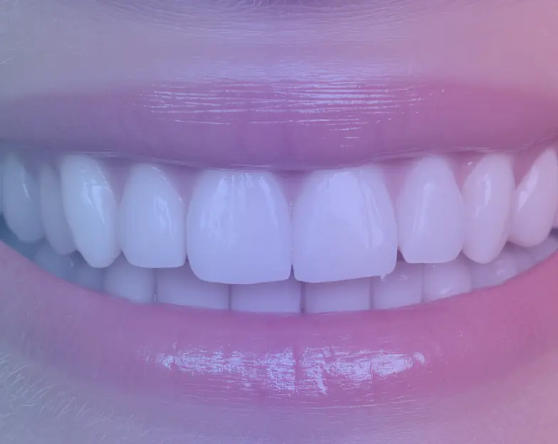 Medical and dental marketing in UAE: Close-up of teeth and lips for the cosmetic bonding service tile, supporting specialty-led healthcare marketing