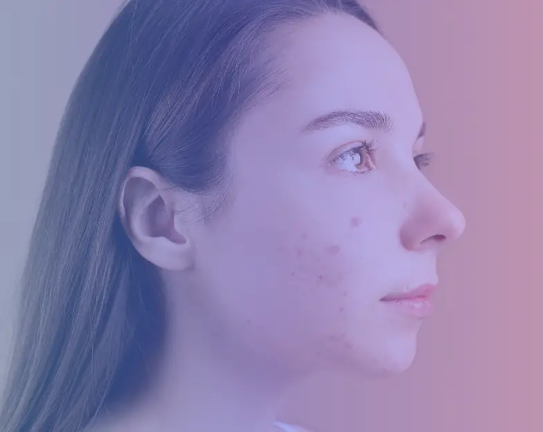 Medical and dental marketing in UAE: Side profile of a woman's face for the common skin-concerns section, supporting aesthetic clinic marketing UAE