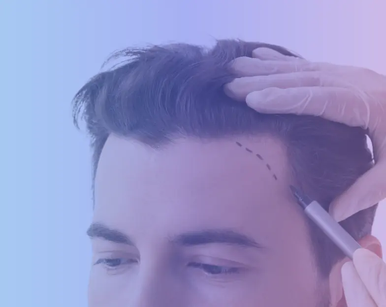 Medical and dental marketing in UAE: Gloved hand marking a man's hairline during a consultation for Hair and Scalp Concerns, supporting specialty-led healthcare marketing