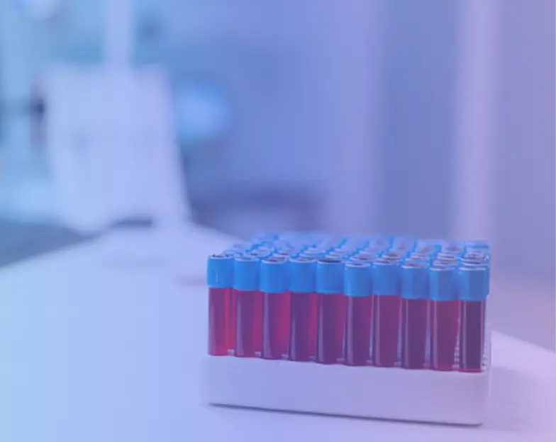 Medical and dental marketing in UAE: Rack of capped sample tubes on a laboratory bench for Laboratory and Pathology Services, supporting diagnostic centre marketing