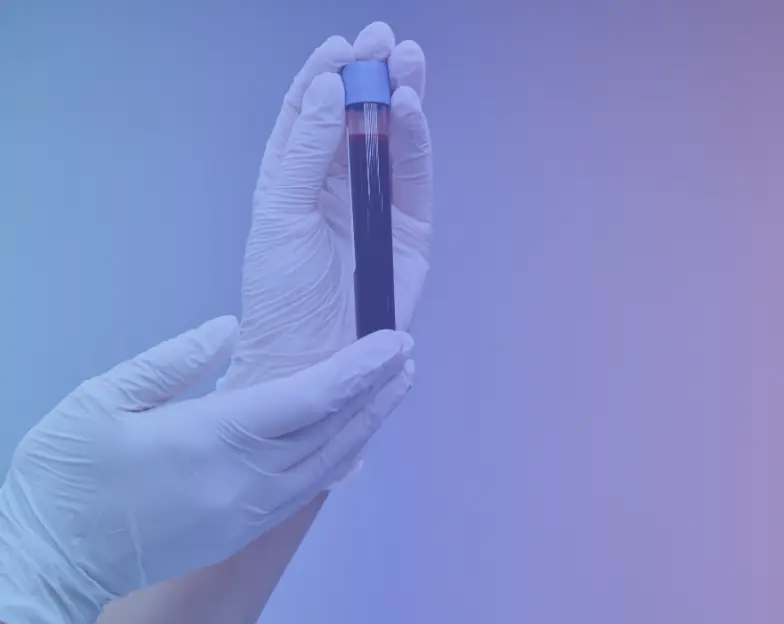 Medical and dental marketing in UAE: Gloved hands holding a capped sample tube for Health Screening and Check-Up Services, supporting specialty-led healthcare marketing